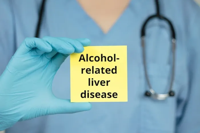 Alcohol-Related Liver Disease